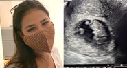 Simone mostrou primeiro ultrassom do 2º filho na web - Foto: Reprodução/ YouTube