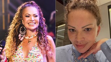 Solange Almeida mostrou como está o seu rosto após procedimentos