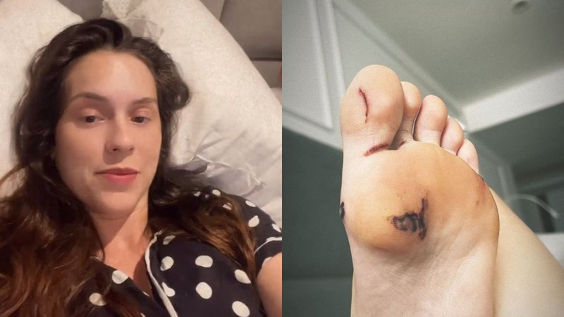 Sophia Abrahão mostra machucado e relata desmaio - Foto: Reprodução / Instagram
