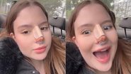 Sophia Valverde mostrou antes e depois de plástica no nariz