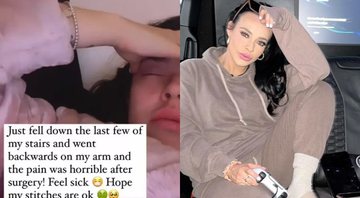 A atriz Stephanie Davis relatou o acidente em suas redes sociais - Foto: Reprodução / Instagram