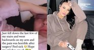 A atriz Stephanie Davis relatou o acidente em suas redes sociais - Foto: Reprodução / Instagram