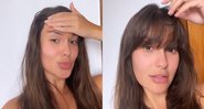 Ex-BBB comentou sobre os resultados dos procedimentos nas redes sociais - Foto: Reprodução / Instagram