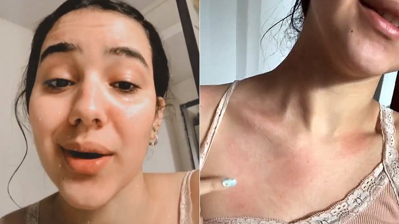 Thaleesa contou que precisa tomar antialérgico antes de tomar banho para amenizar o problema - Foto: Reprodução/ Instagram