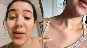 Thaleesa contou que precisa tomar antialérgico antes de tomar banho para amenizar o problema - Foto: Reprodução/ Instagram