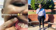 Aviwe Mazosiwe mostrou sua rotina de boca fechada por sete semanas nas redes sociais - Foto: Reprodução / TikTok