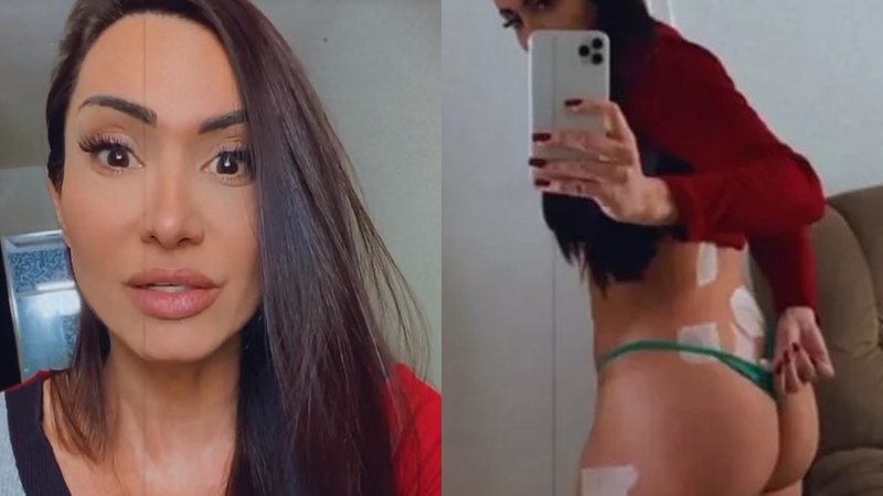 Vanessa Rangeli desabafa sobre acidente doméstico - Foto: Reprodução / Instagram @vanessa.rangeli