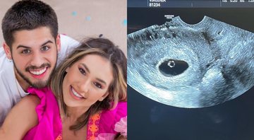 Virginia Fonseca está grávida pela segunda vez e mostra primeira imagem de ultrassom no Instagram - Foto: Reprodução / Instagram
