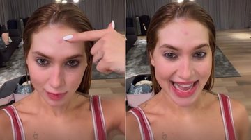 Virginia Fonseca mostrou calombo causado por fantasia de carnaval