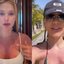 Virginia Fonseca mostrou queimadura de sol em vídeo