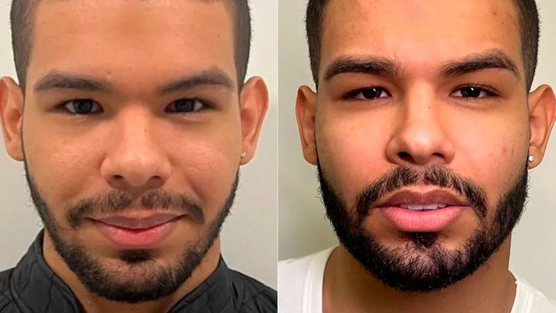 Ex-BBB Vyni foi comparado ao rapper Drake após harmonização - Foto: Reprodução/ Instagram