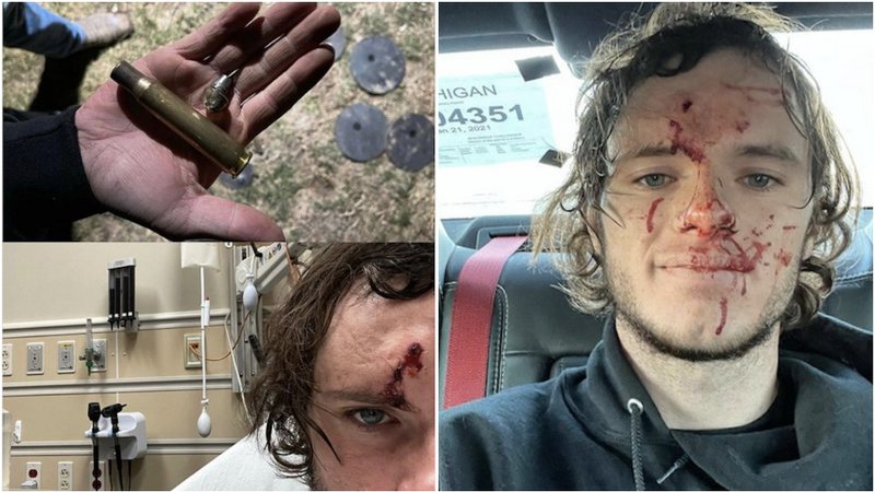 O youtuber WhistlinDiesel mostra bala que o atingiu na cabeça depois de ricochetear - Foto: Reprodução / Instagram@WhistlinDiesel