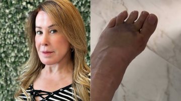 Zilu Camargo fraturou o pé após cair da escada