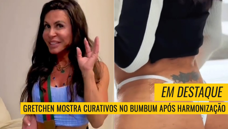Gretchen procedimento bumbum