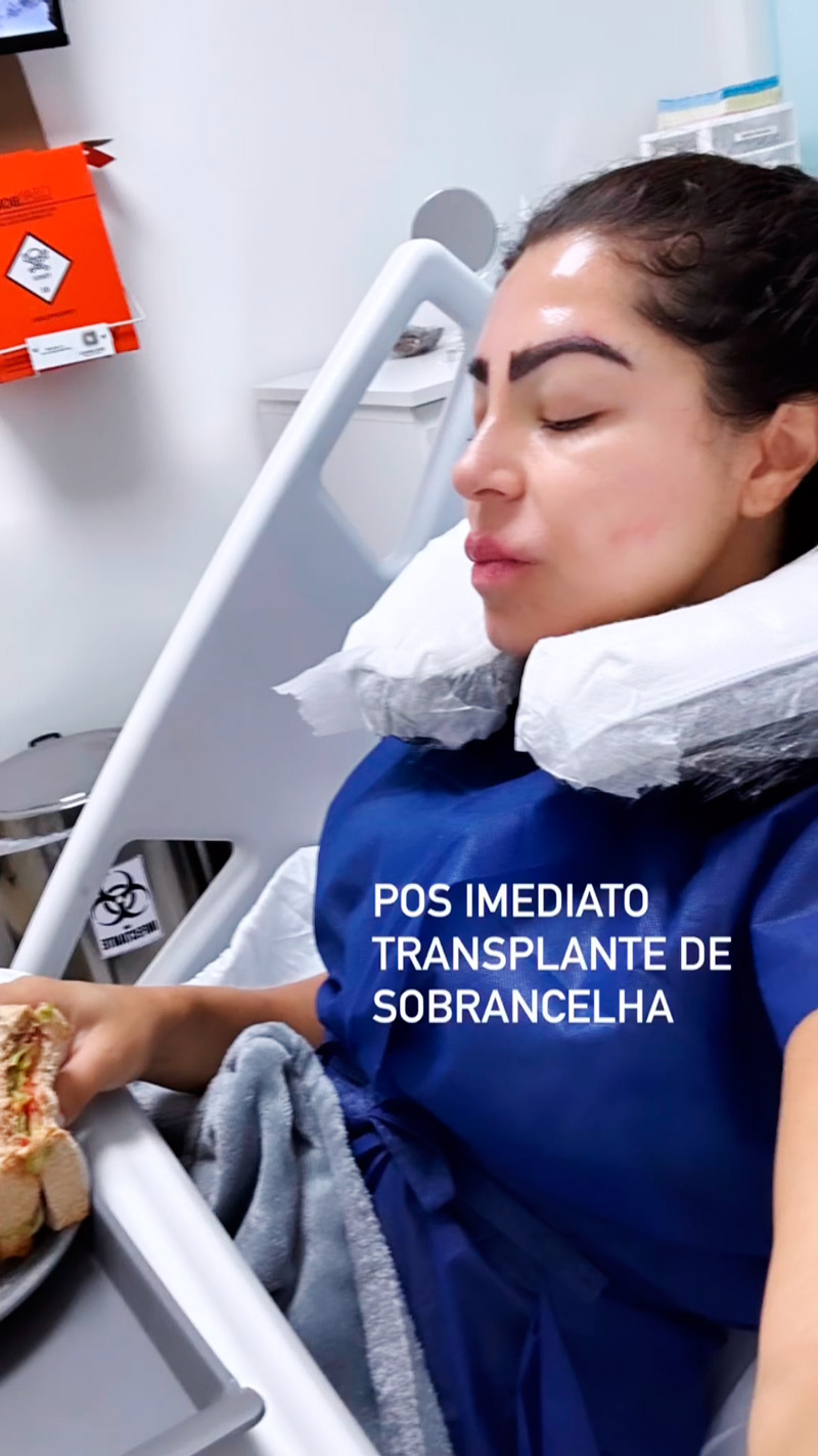 Andressa Ferreira mostrou resultado de transplante de sobrancelhas - Foto: Reprodução/ @andressaferreiramiranda