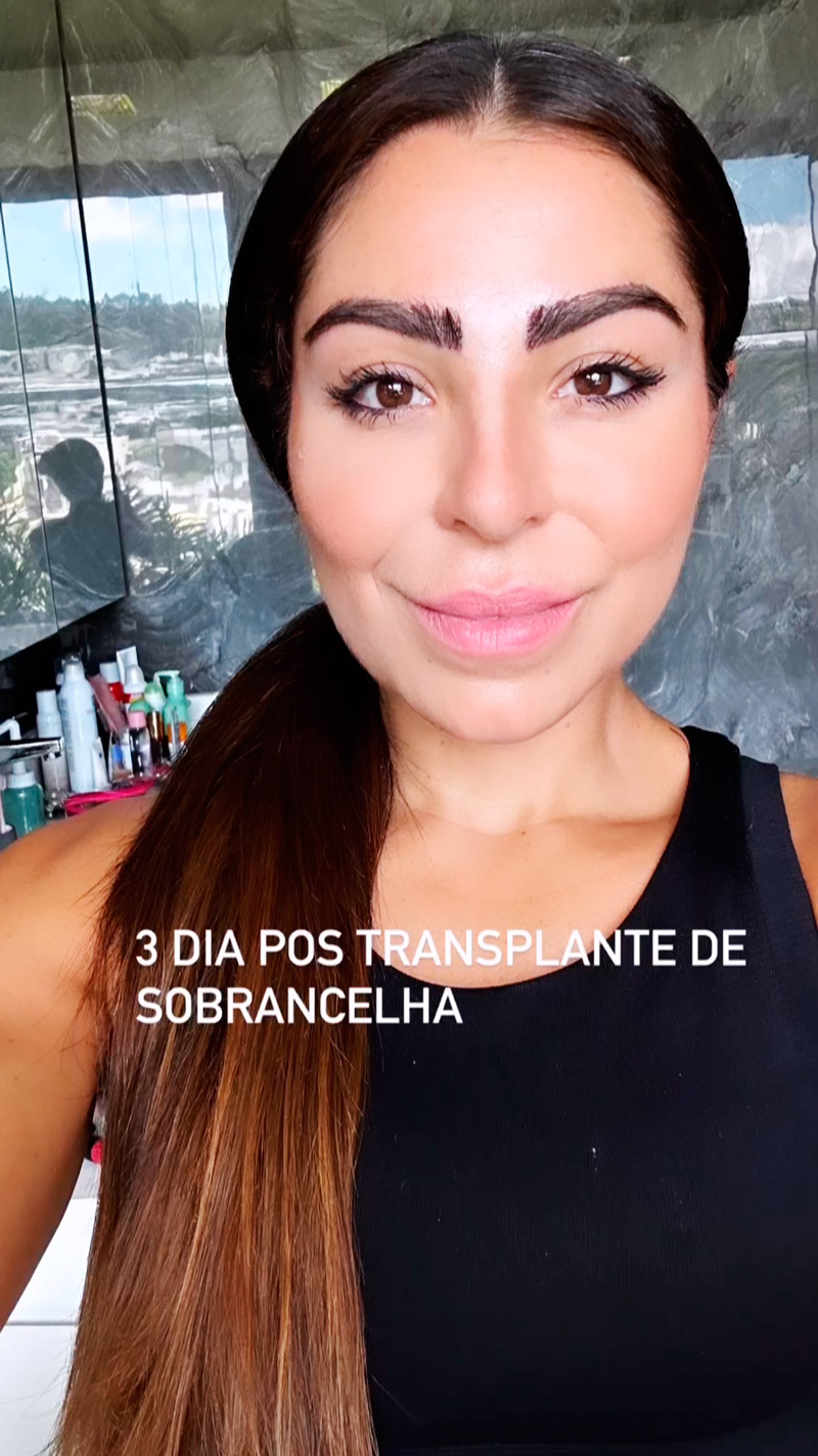 Andressa Ferreira mostrou resultado de transplante de sobrancelhas - Foto: Reprodução/ Instagram@andressaferreiramiranda