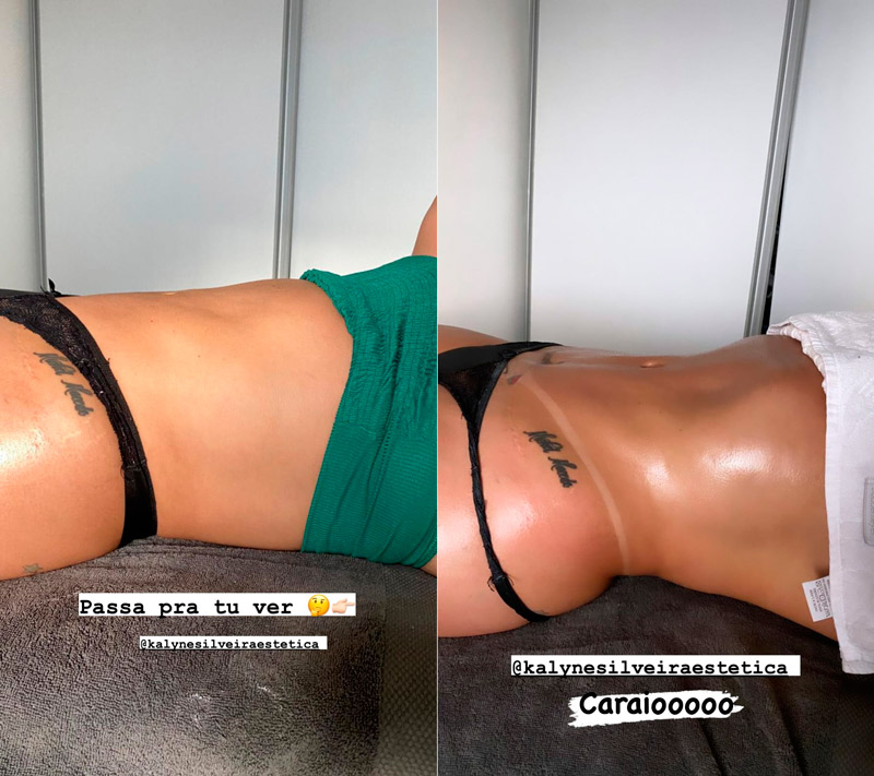 Andressa Soares mostrou antes e depois de massagem modeladora - Foto: Reprodução/ Instagram@mulhermelanciaoficial