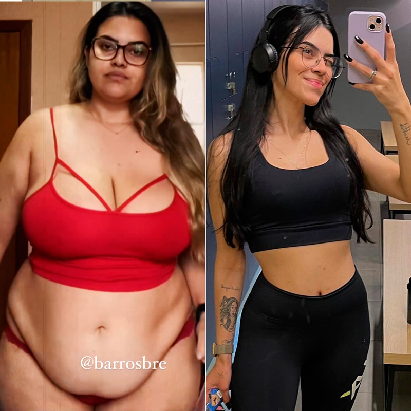 Brenda Barros antes e depois do emagrecimento e das cirurgias reparadoras - Foto: Reprodução/ Instagram@barrosbre