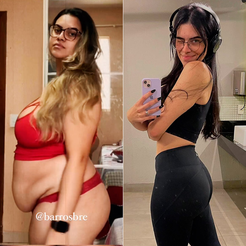 Brenda Barros antes e depois do emagrecimento e das cirurgias reparadoras - Foto: Reprodução/ @barrosbre