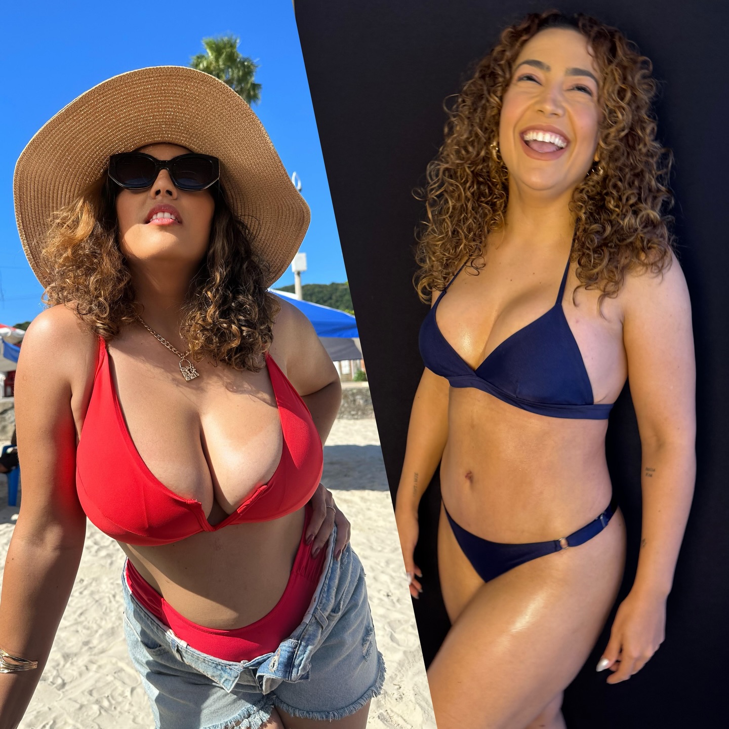 Camila Moura mostrou antes e depois das plásticas - Foto: Reprodução/ Instagram@camilamoura225