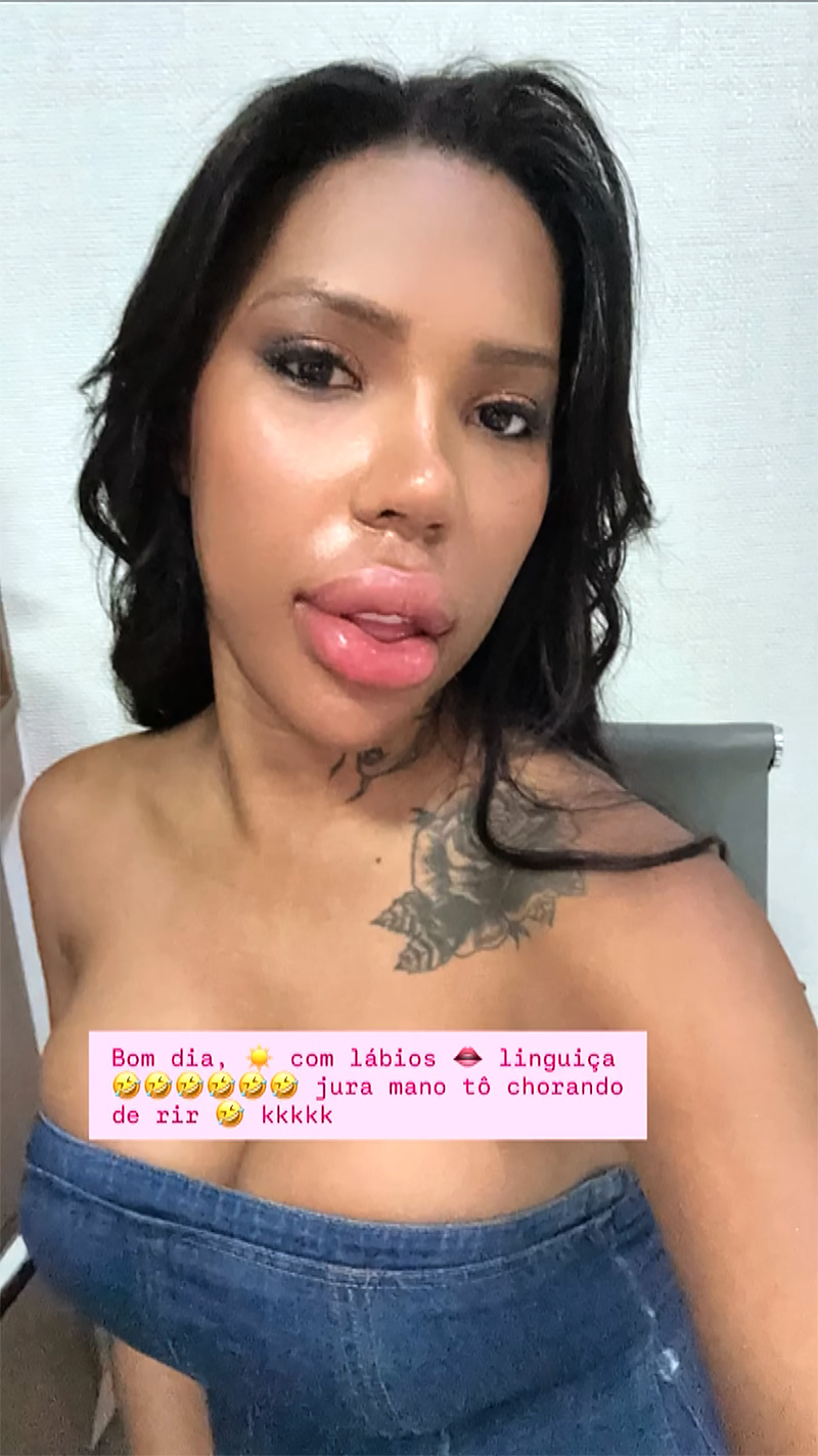 Carol Lekker apareceu com os lábios super inchados após remover preenchimentos - Foto: Reprodução/ Instagram@carollekker_