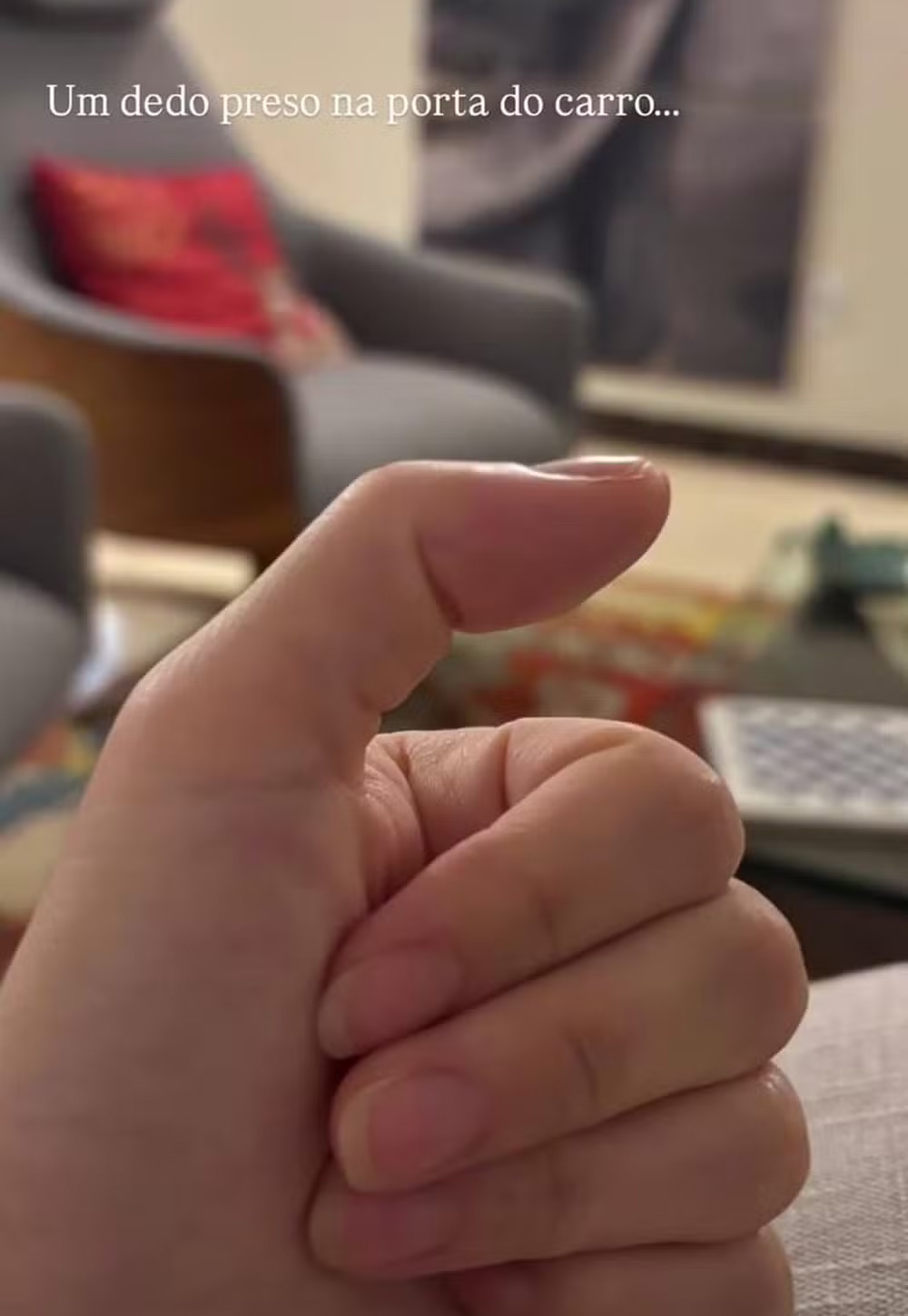 Carol Macedo passou por cirurgia após prender o dedo na porta do carro - Foto: Reprodução/ Instagram