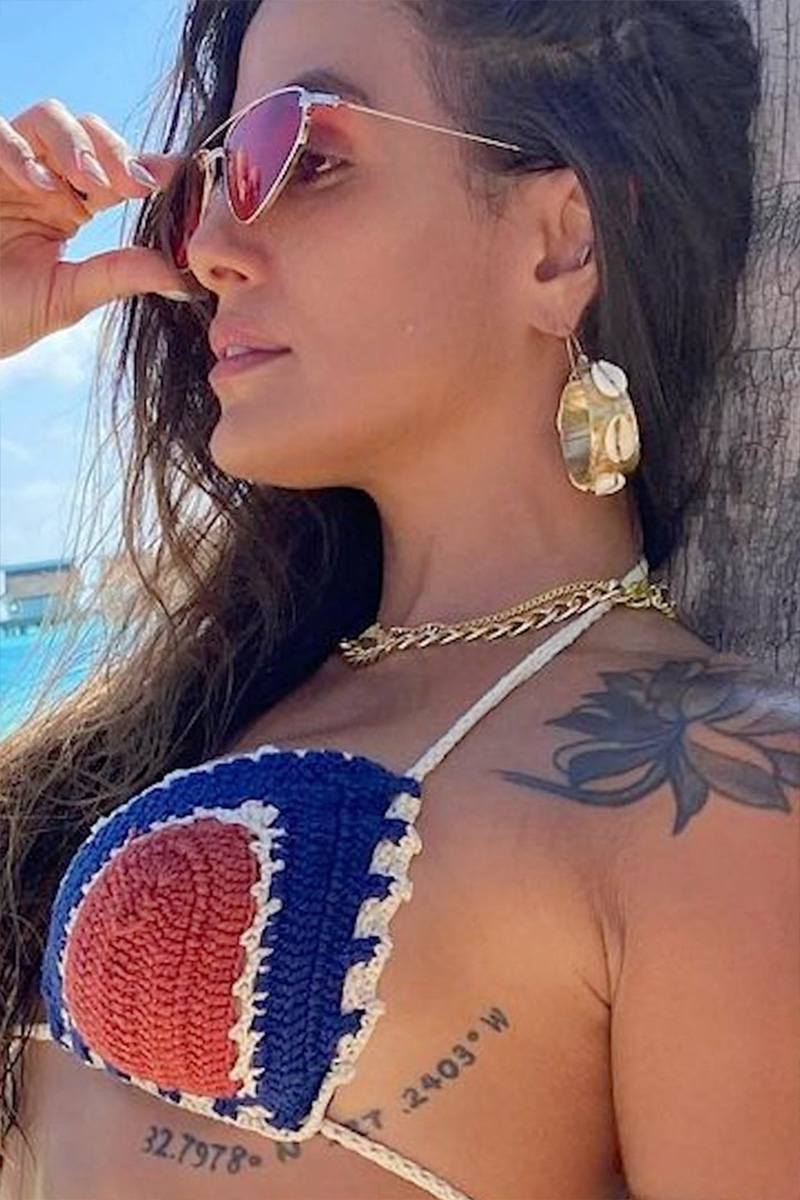 Carol Peixinho mostrou o processo de remoção de tatuagem - Foto: Reprodução/ Instagram@carolpeixinho