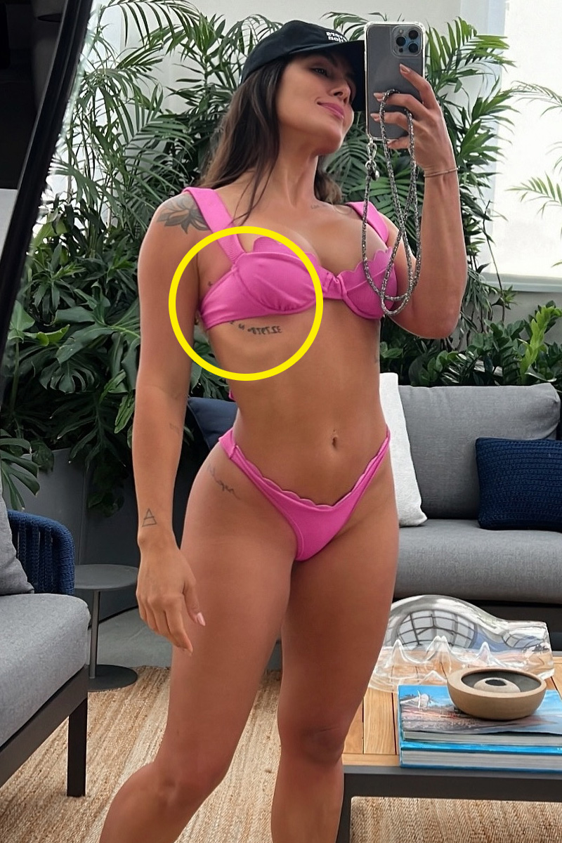 Carol Peixinho mostrou o processo de remoção de tatuagem - Foto: Reprodução/ Instagram@carolpeixinho