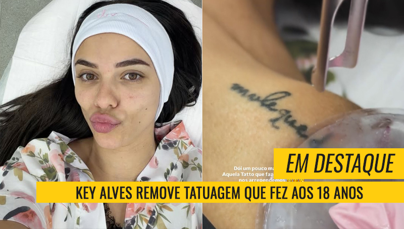 Key Alves remove tatuagem