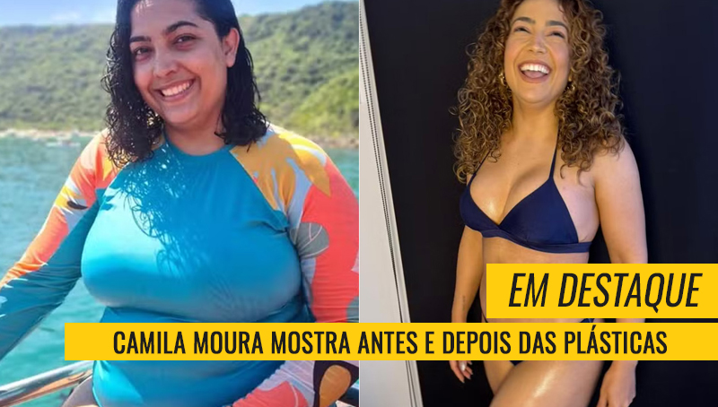Camila Moura plásticas