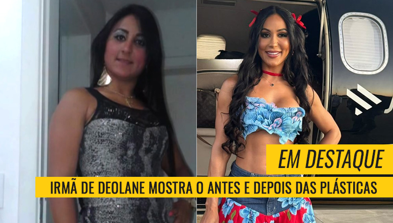 Dayane Bezerra plásticas