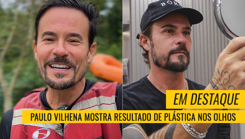 Paulo Vilhena plásticas