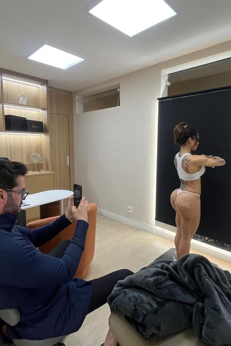 Fabi Frota mostrou curativos após tratamento no bumbum - Foto: Divulgação
