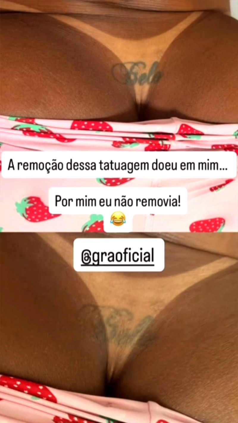 Gracyanne Barbosa começou a apagar tatuagem que fez para Belo - Foto: Reprodução/ Instagram@graoficial