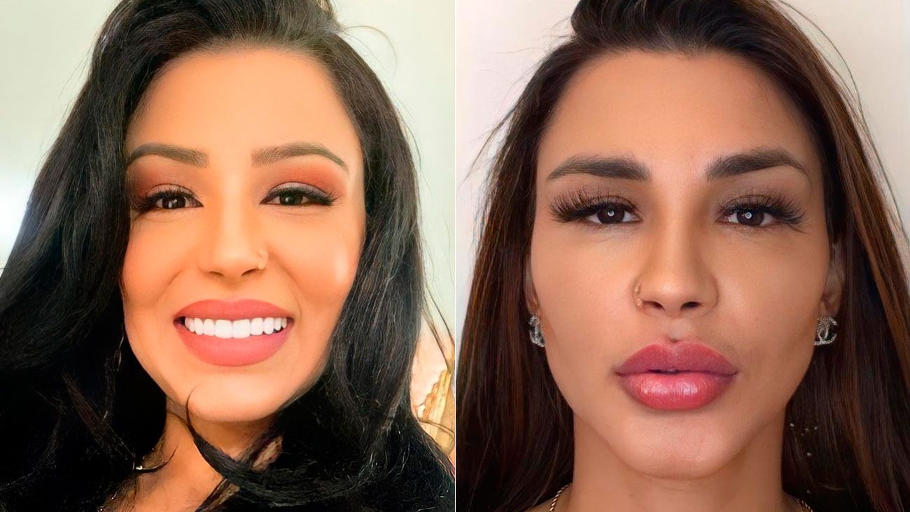 Jenny Miranda mostra antes e depois e harmonização facial feita pelo  namorado - Revista Marie Claire