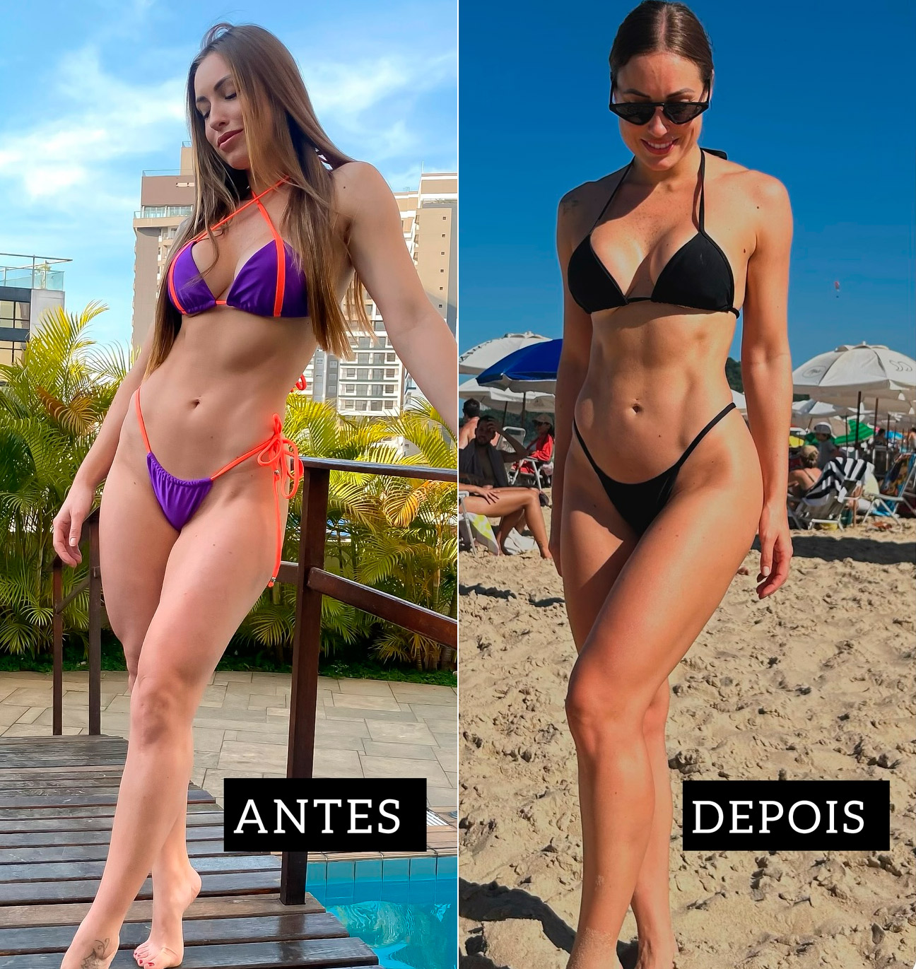 Jéssica Mueller mostrou antes e depois de procedimento - Foto: Reprodução/ Instagram@eujessicamueller