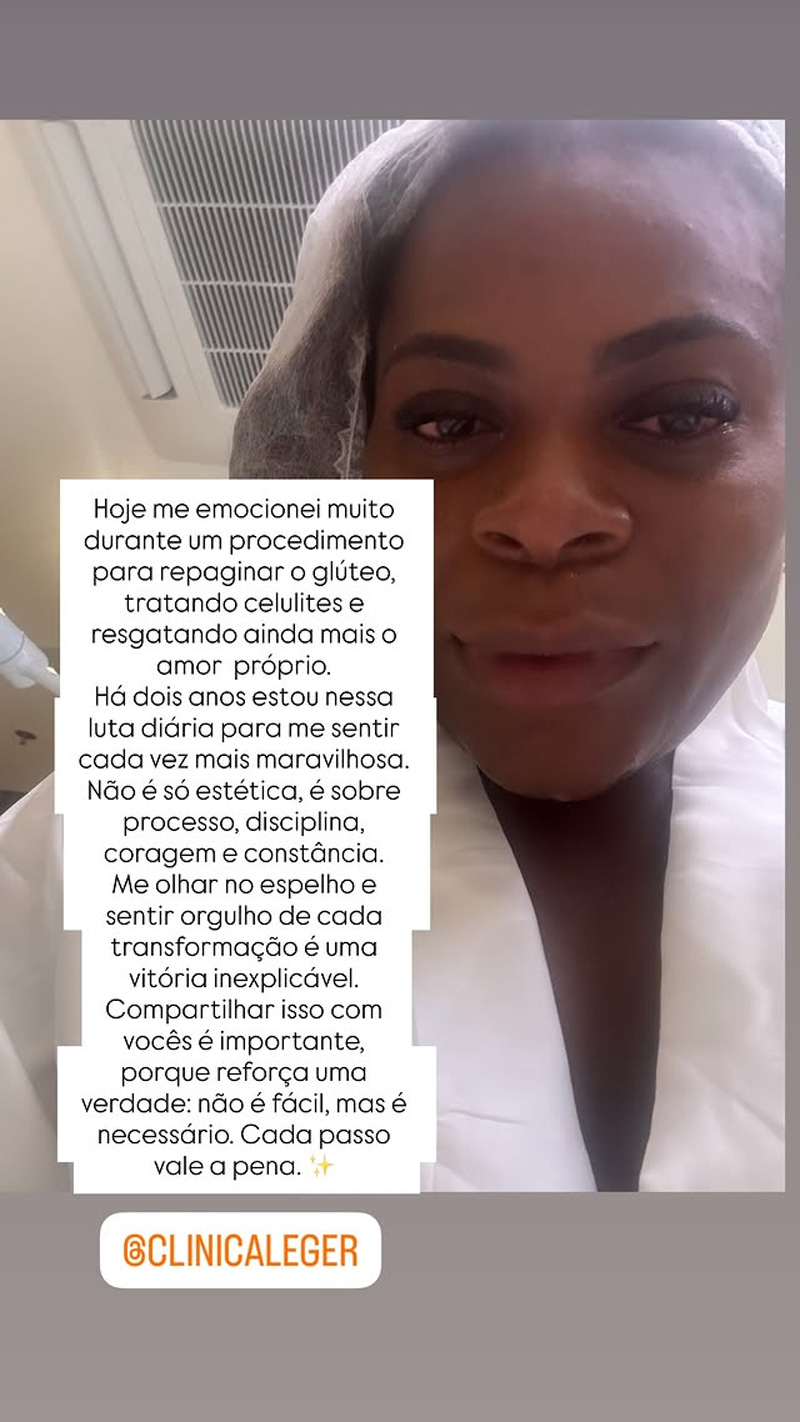 Jojo Todynho fez procedimento para remodelar os glúteos - Foto: Reprodução/ Instagram@jojotodynho