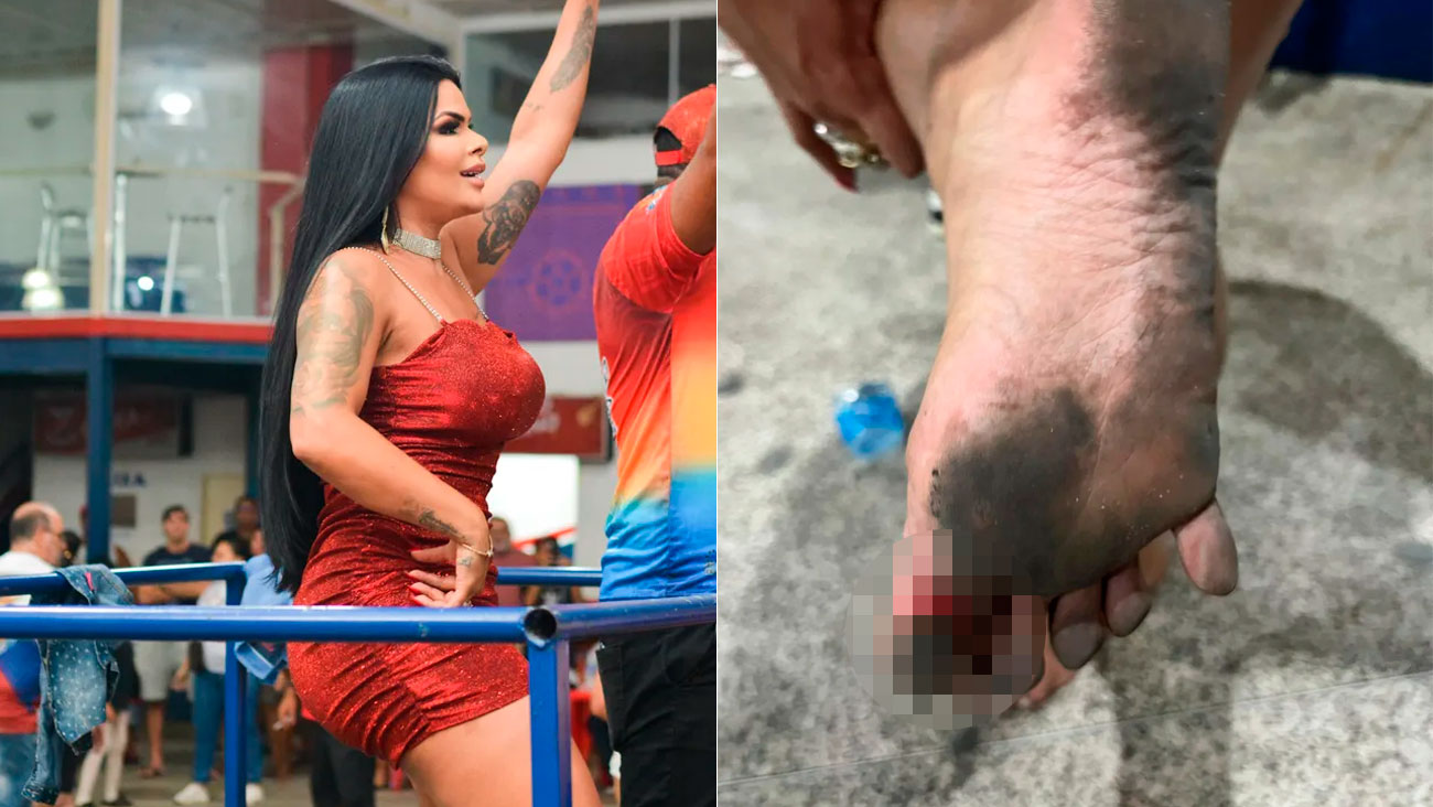 Cenapop · Rainha de bateria deixa quadra com os pés sangrando: “Não senti  na hora”