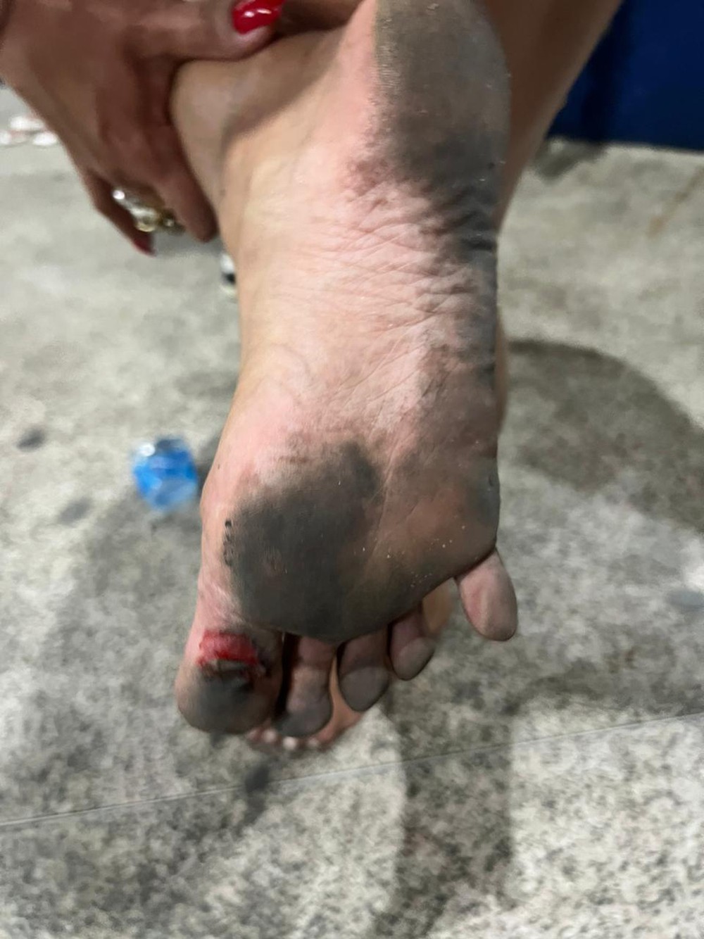 Juliana Souza saiu da quadra com os pés machucados - Foto: Divulgação/ Adriano Reis/ Palmer Assessoria de Comunicação