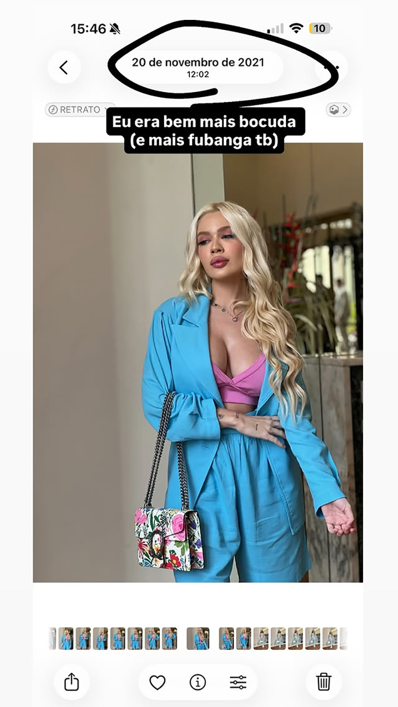 Karoline Lima postou foto antiga (à direita) e falou sobre retirada de procedimentos - Foto: Reprodução/ Instagram@karolinel