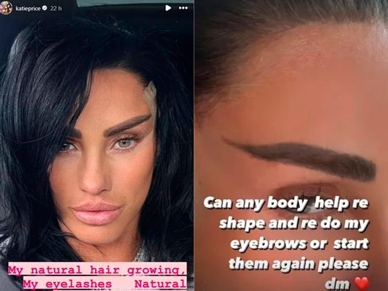 Katie Price disse que “odiou” sobrancelhas após procedimento de R$ 73 mil - Foto: Reprodução/ Instagram@katieprice