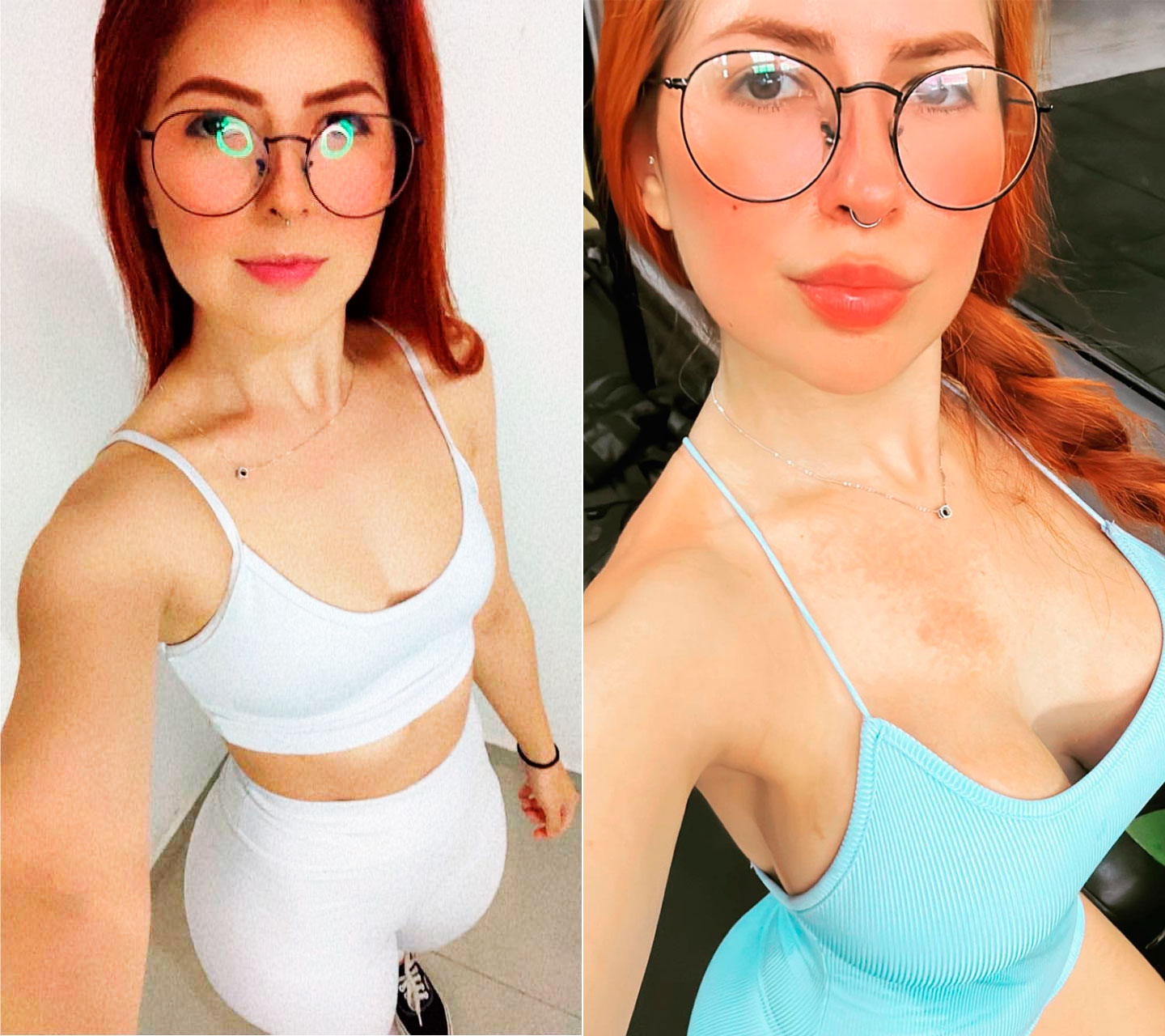 Kelly Cristina antes e depois de seus procedimentos estéticos - Foto: Reprodução/ @oficial.kellycris