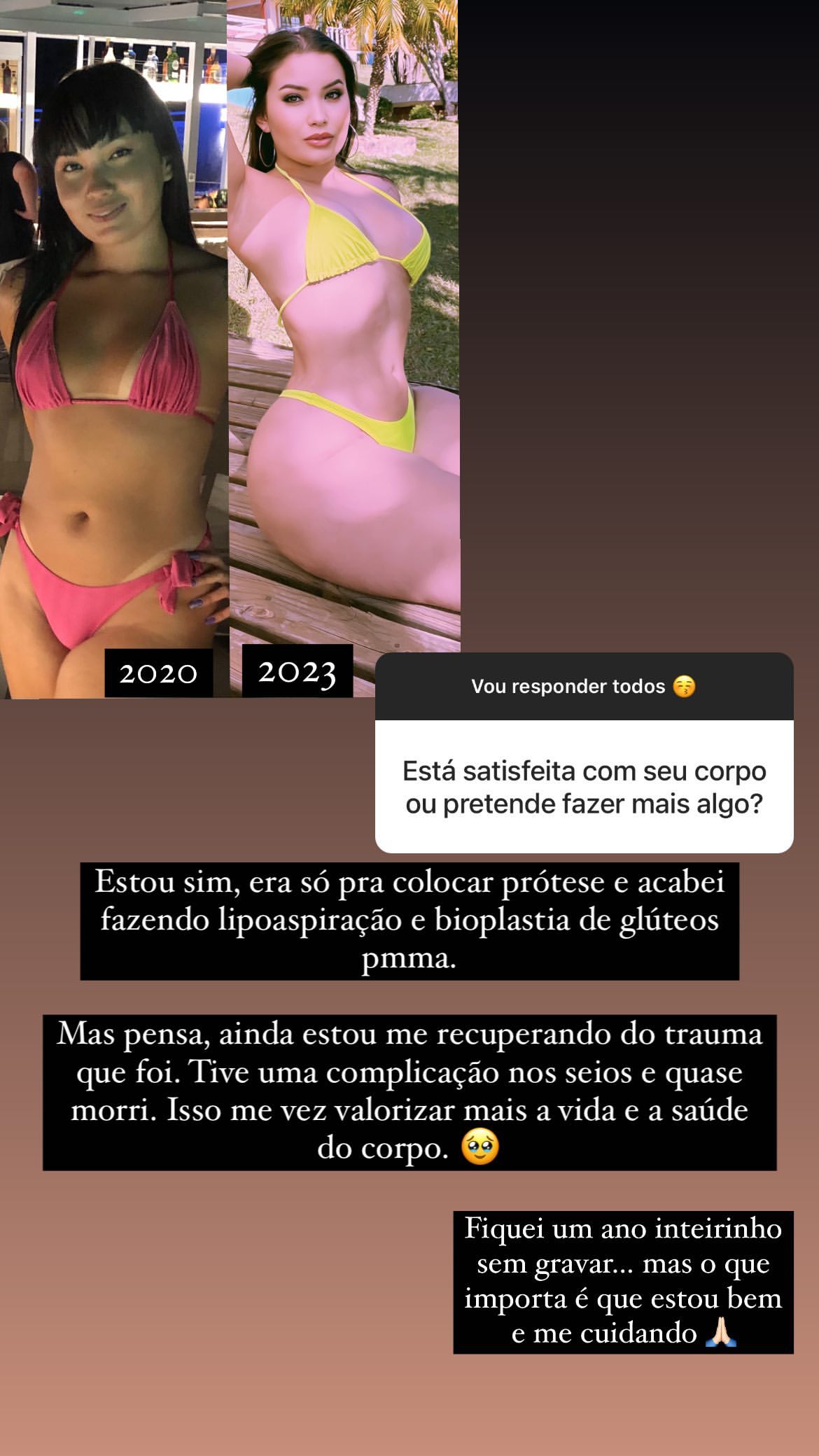 Lina Nakamura mostrou antes e depois e falou sobre plásticas - Foto: Reprodução/ Instagram@soylinanakamura
