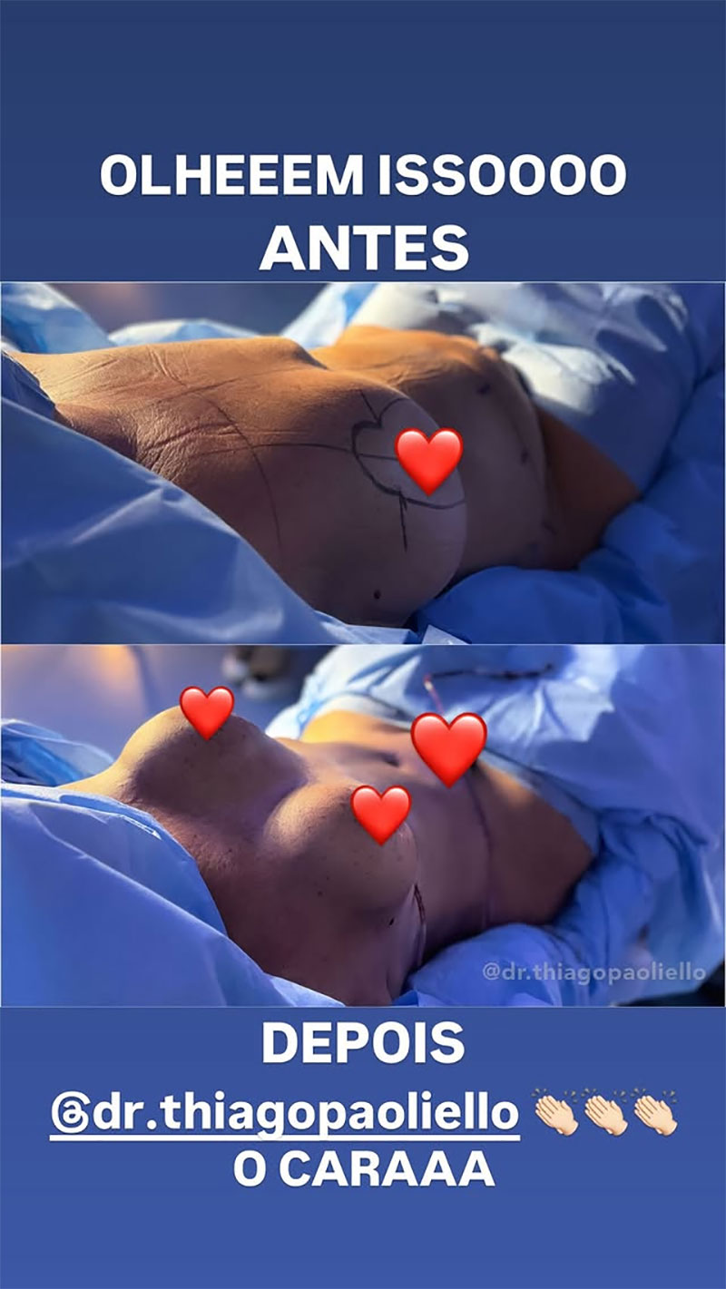 Virginia mostrou antes e depois das plásticas da mãe, Margareth Serrão - Foto: Reprodução/ Instagram@virginia