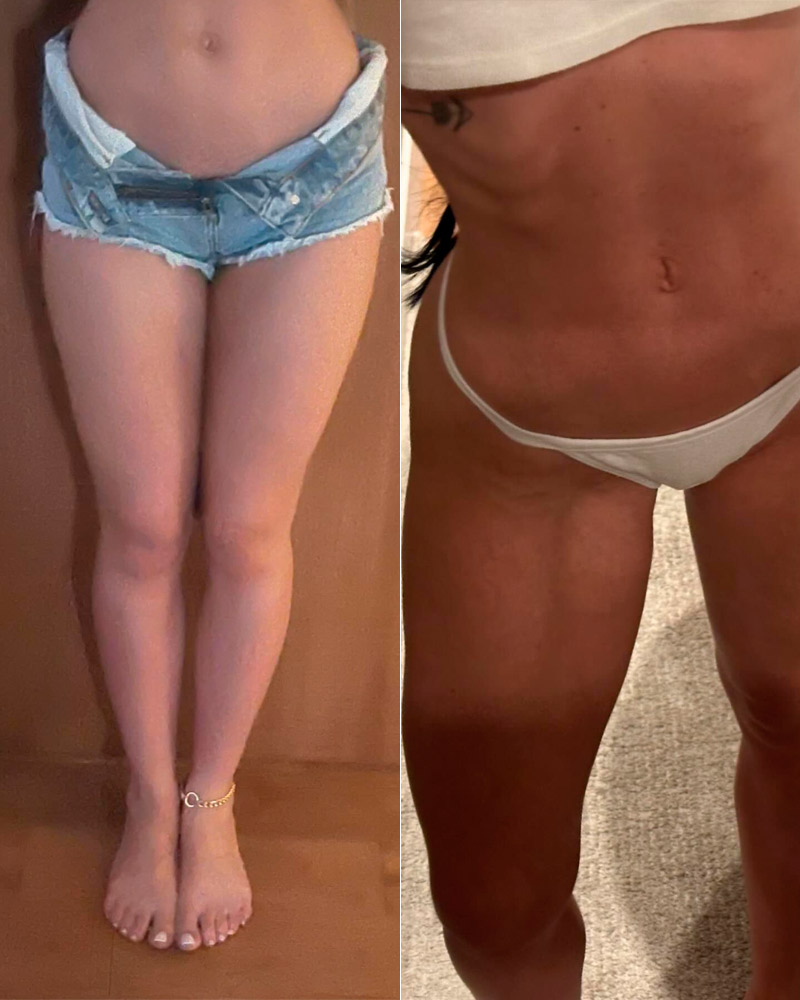 Maria Lina mostrou antes e depois e rebateu críticas ao corpo - Foto: Reprodução/ Instagram@marialdgg