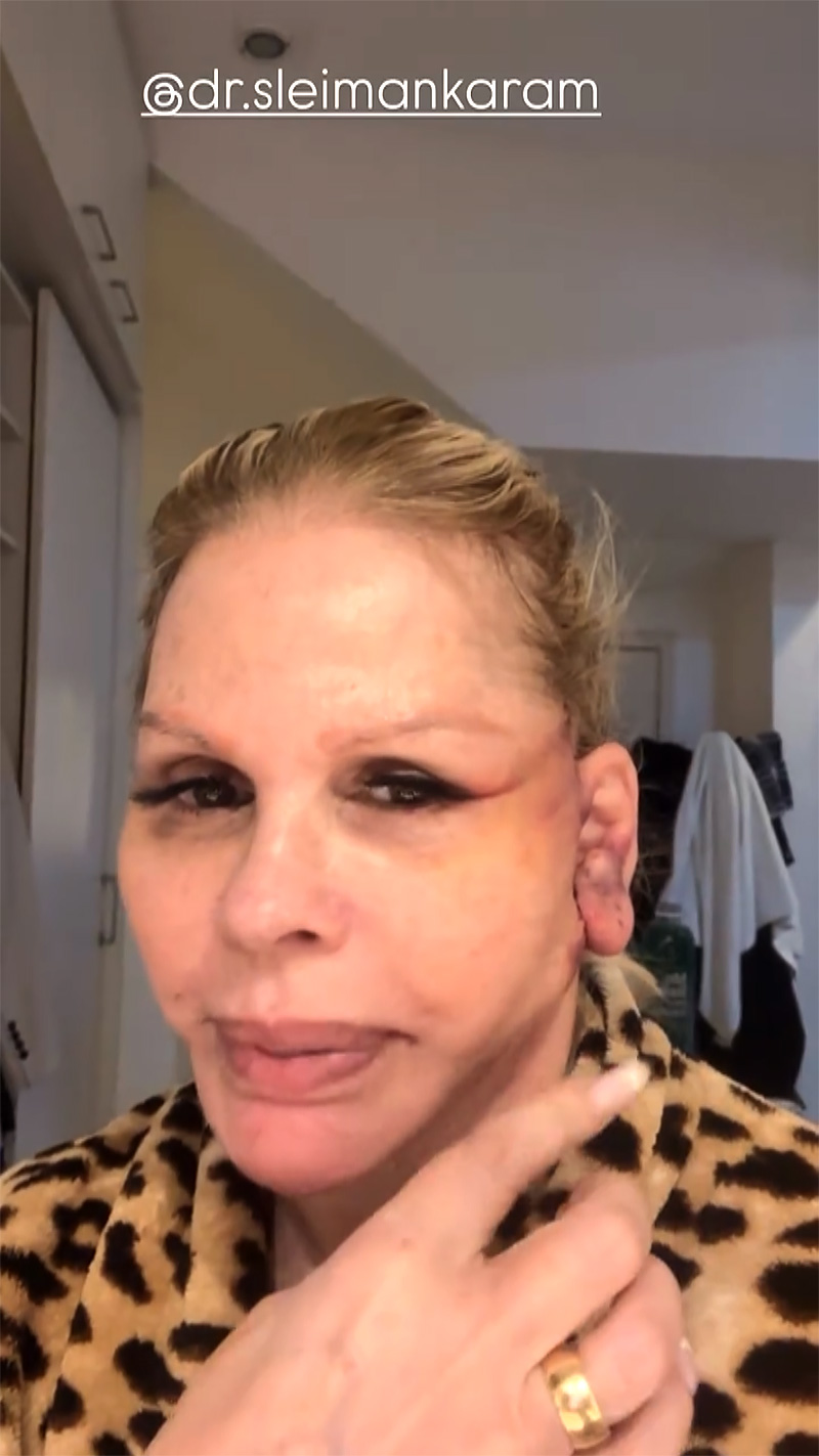 Monique Evans disse que teve problemas com o aplicativo do banco após cirurgia facial - Foto: Reprodução/ Instagram@moniquevansreal