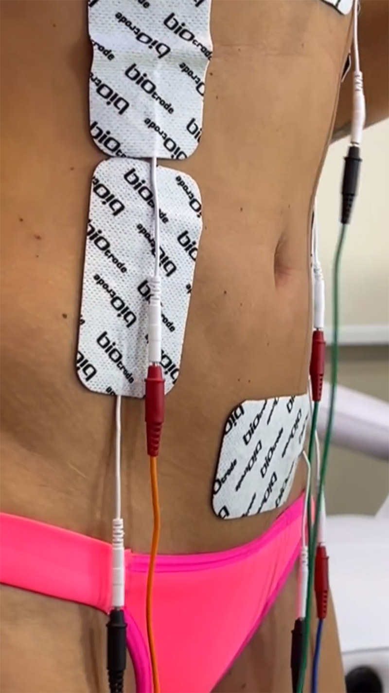 Natalia Casassola mostrou procedimento para tonificar o corpo - Foto: Reprodução/ Instagram@naticasassola