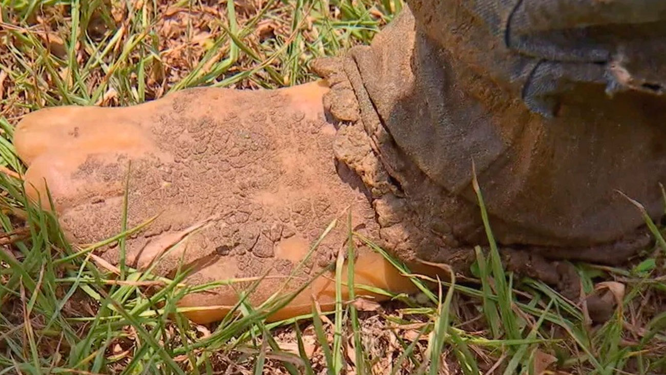 Osmar Prado usa calçado de silicone para não machucar os pés - Foto: Reprodução/ TV Globo