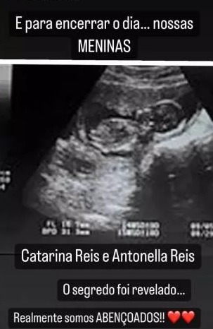 Priscila Pires, mãe de dois meninos, anuncia gravidez de gêmeas