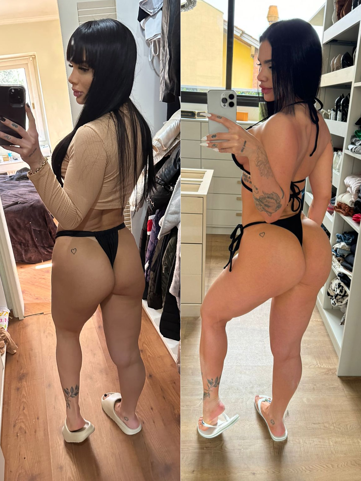 Raíssa Souza mostrou antes e depois do bumbum após procedimento - Foto: Arquivo pessoal